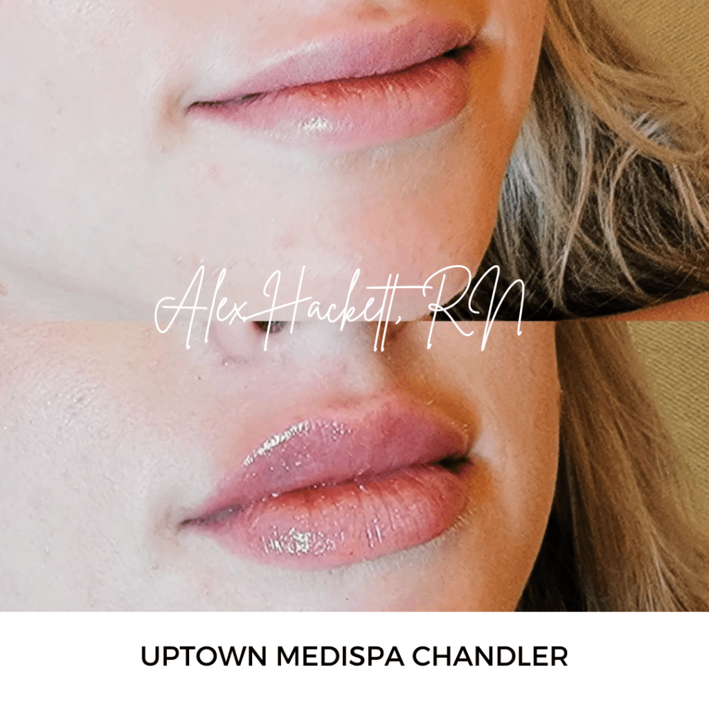 Lips by Alex Hackett, RN
